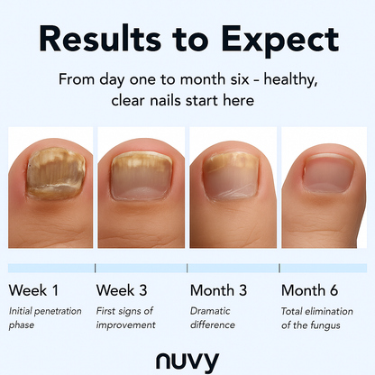 nuvy™ Anti-Fungal Toenail Repair Pen